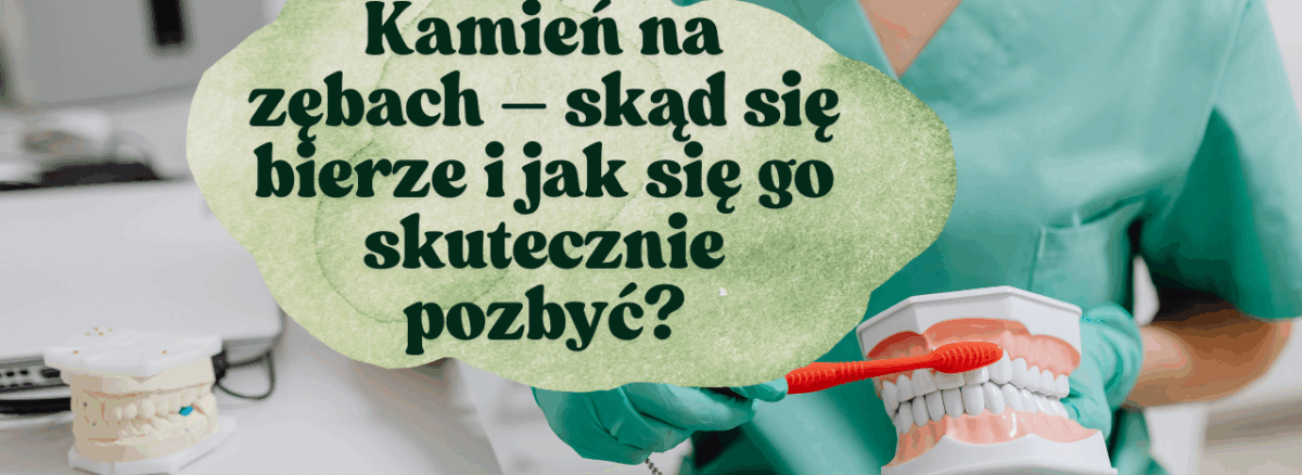 Kamień na zębach – skąd się bierze i jak się go skutecznie pozbyć?