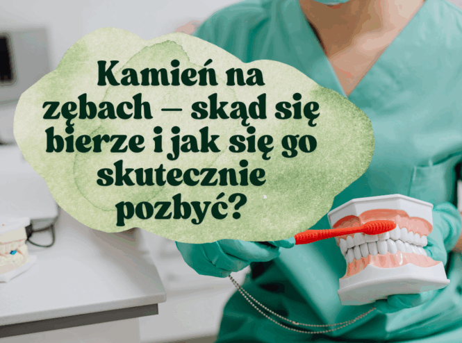 Kamień na zębach – skąd się bierze i jak się go skutecznie pozbyć?