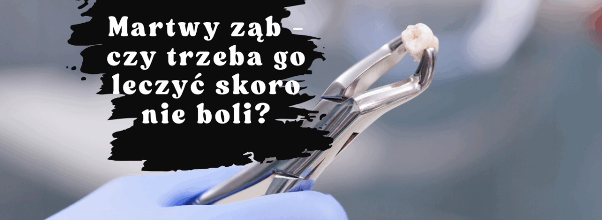 Martwy ząb - czy trzeba go leczyć skoro nie boli