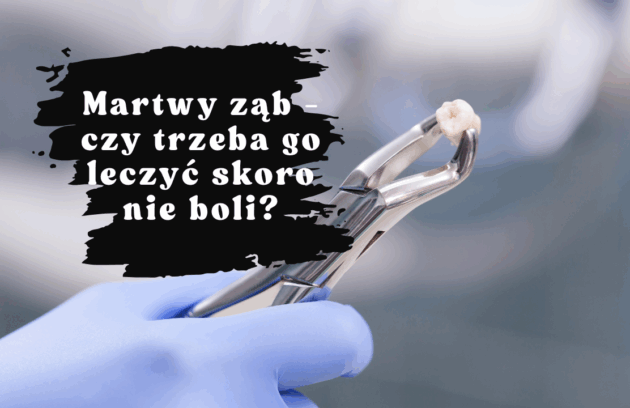 Martwy ząb - czy trzeba go leczyć skoro nie boli