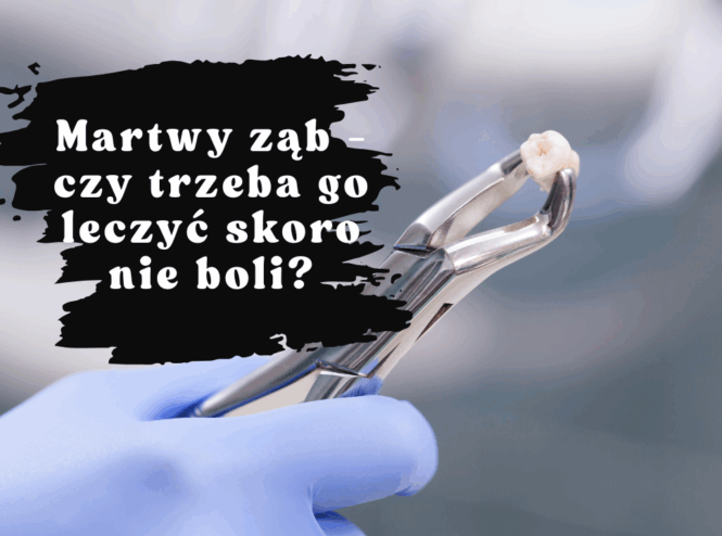 Martwy ząb - czy trzeba go leczyć skoro nie boli