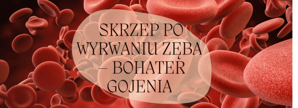 Skrzep po wyrwaniu zęba – bohater gojenia