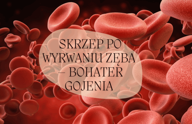 Skrzep po wyrwaniu zęba – bohater gojenia