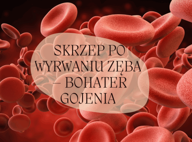 Skrzep po wyrwaniu zęba – bohater gojenia