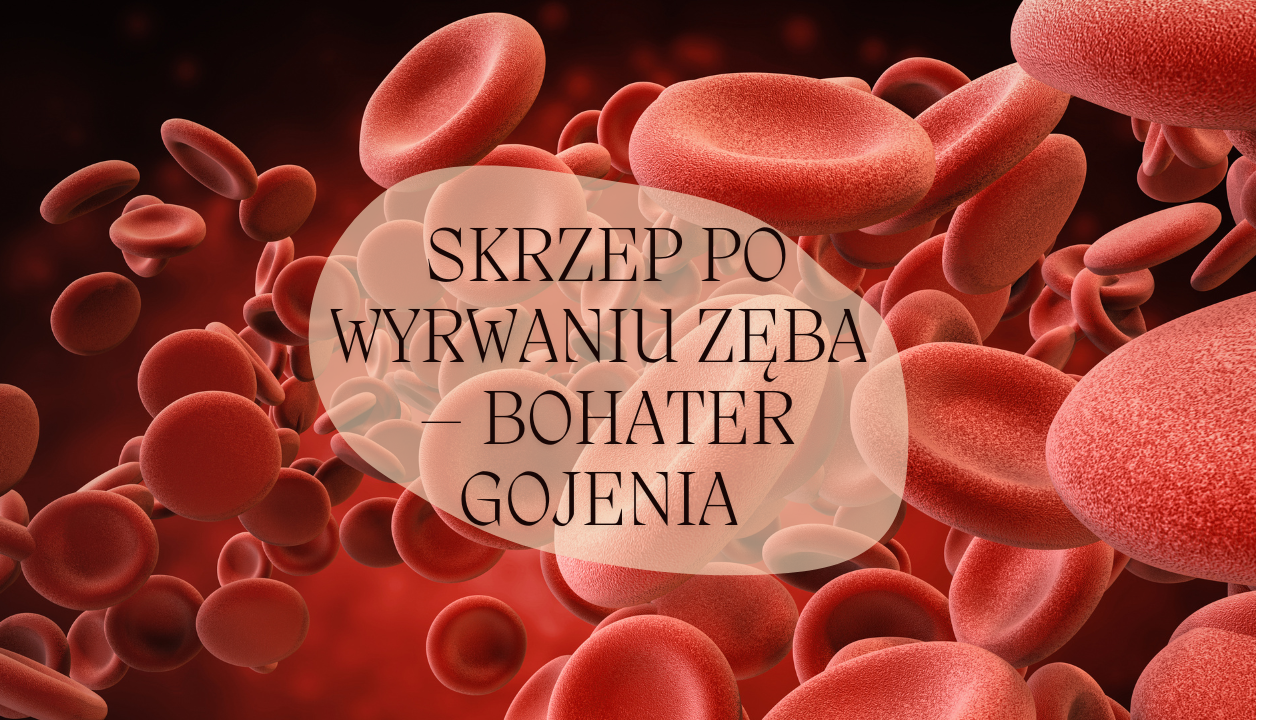Skrzep po wyrwaniu zęba – bohater gojenia