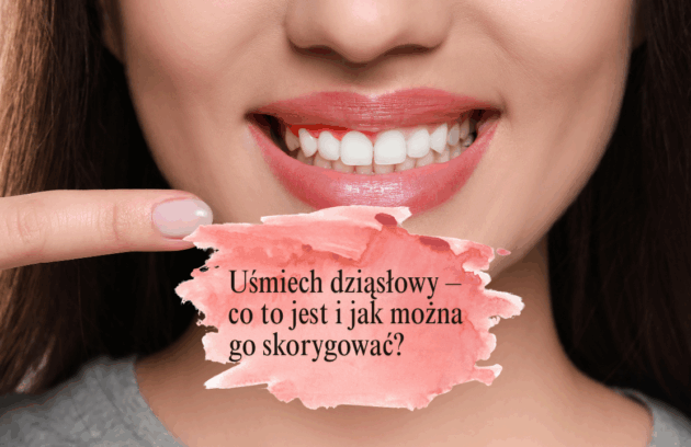 Uśmiech dziąsłowy – co to jest i jak można go skorygować?