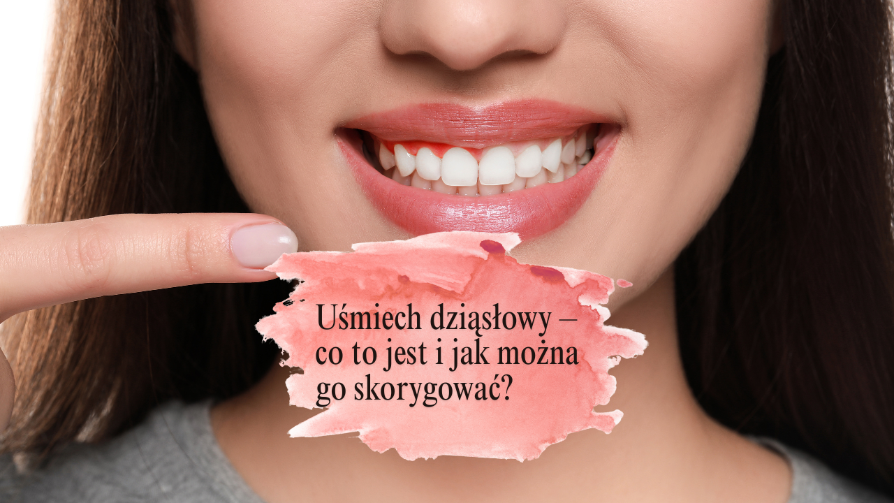 Uśmiech dziąsłowy – co to jest i jak można go skorygować?