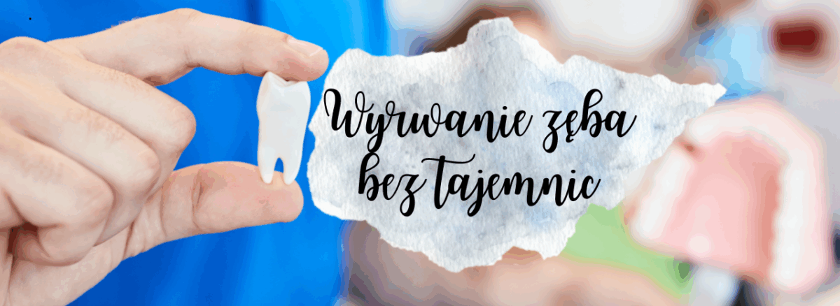 Wyrwanie zęba bez tajemnic