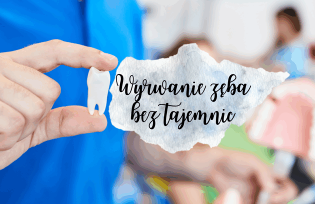 Wyrwanie zęba bez tajemnic