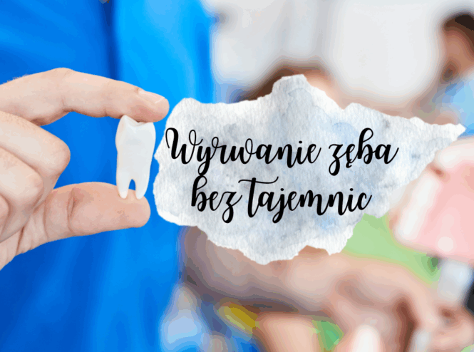 Wyrwanie zęba bez tajemnic