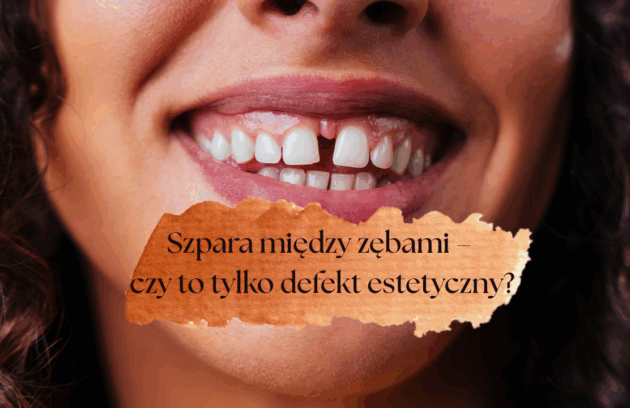 Szpara między zębami – czy to tylko defekt estetyczny?