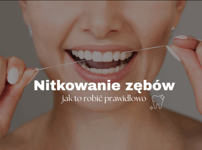 Nitkowanie zębów