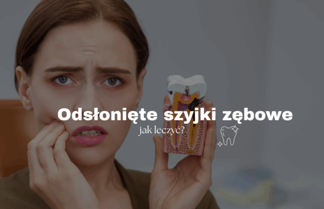 Odsłonięte szyjki zębowe - jak leczyć
