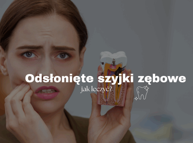 Odsłonięte szyjki zębowe - jak leczyć