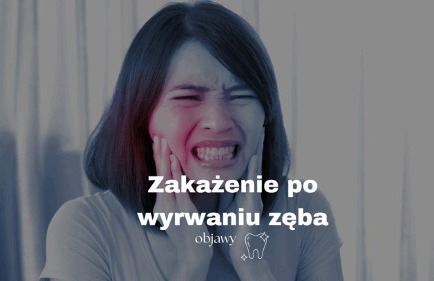 Zakażenie po wyrwaniu zęba - objawy