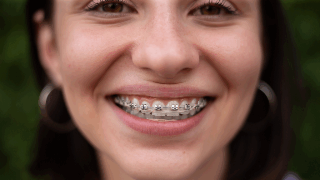 Aparat ortodontyczny cena - odkryj opcje dopasowane do Twojego budżetu