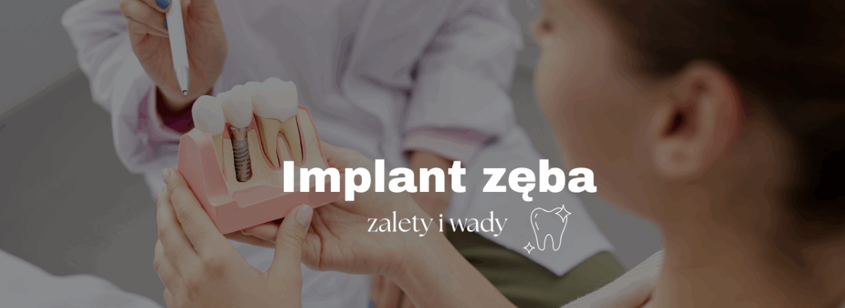 Implant zęba - zalety i wady