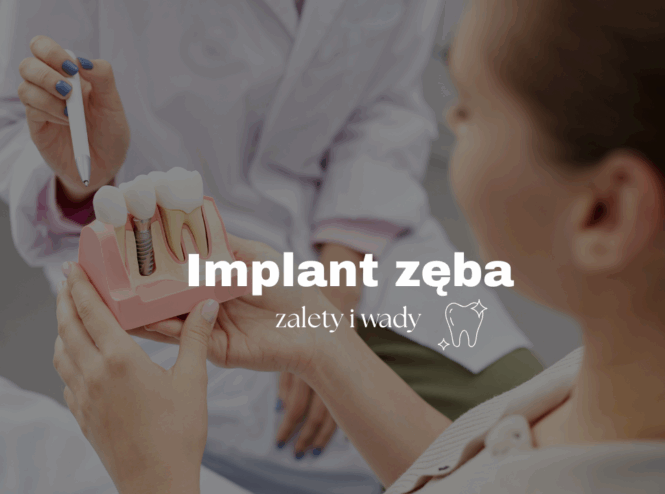 Implant zęba - zalety i wady