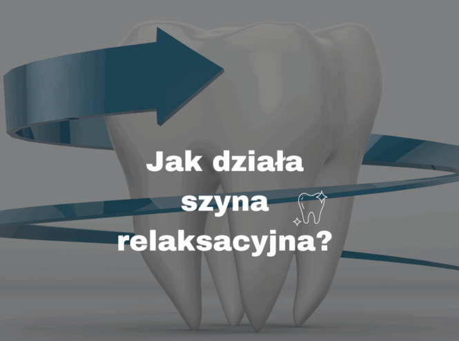 Jak działa szyna relaksacyjna