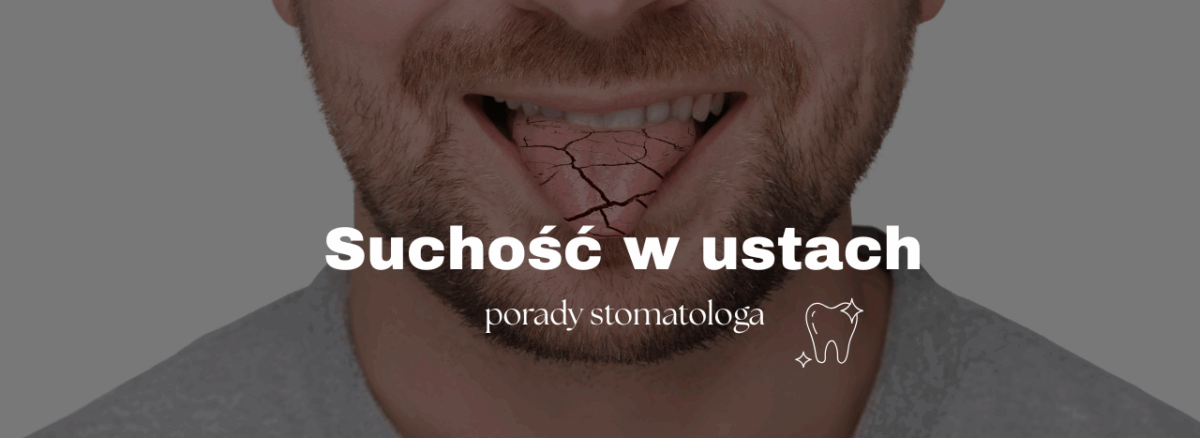 Suchość w ustach – porady stomatologa