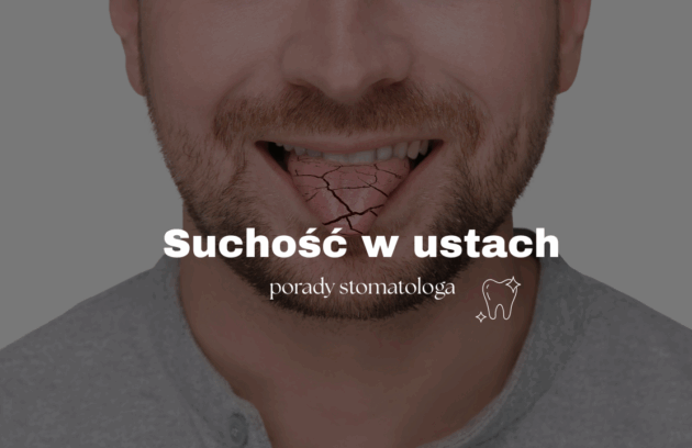 Suchość w ustach – porady stomatologa
