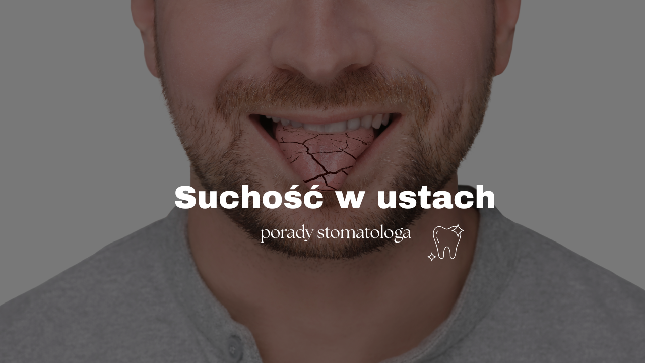 Suchość w ustach – porady stomatologa