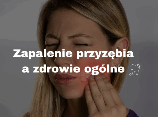 Zapalenie przyzębia a zdrowie ogólne