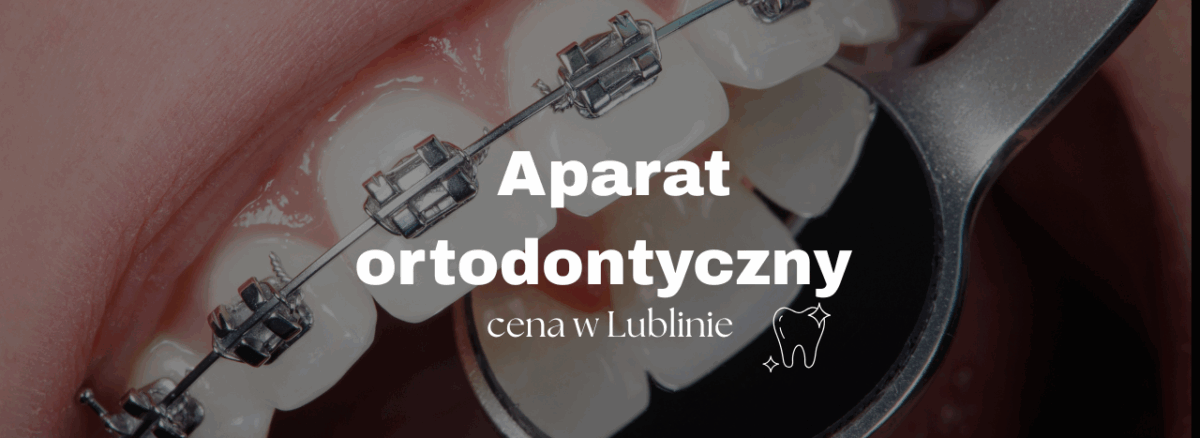 aparat ortodontyczny cena w Lublinie