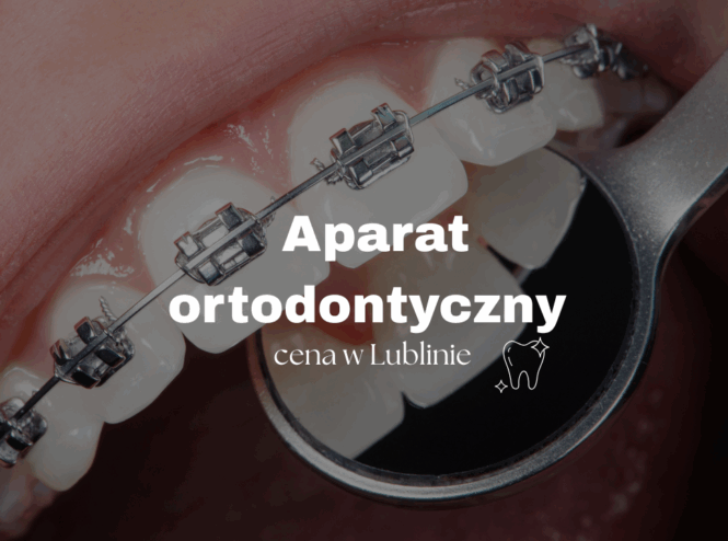 aparat ortodontyczny cena w Lublinie