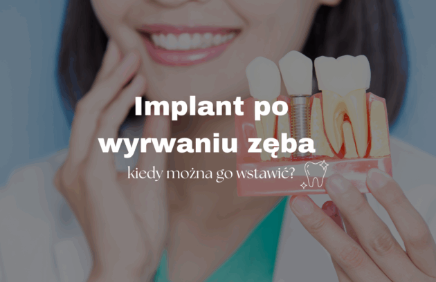 Implant po wyrwaniu zęba – kiedy można go wstawić