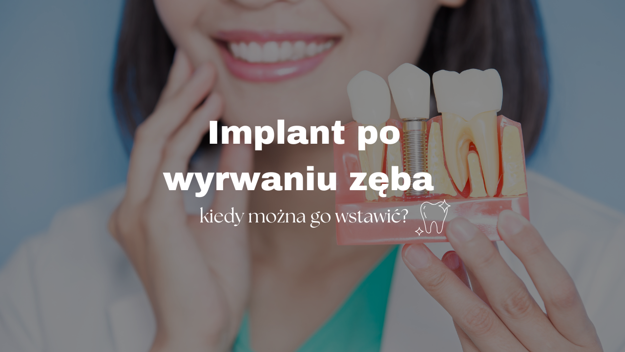 Implant po wyrwaniu zęba – kiedy można go wstawić