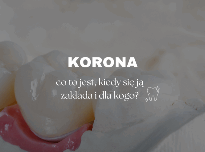 Korona – co to jest, kiedy się ją zakłada i dla kogo?