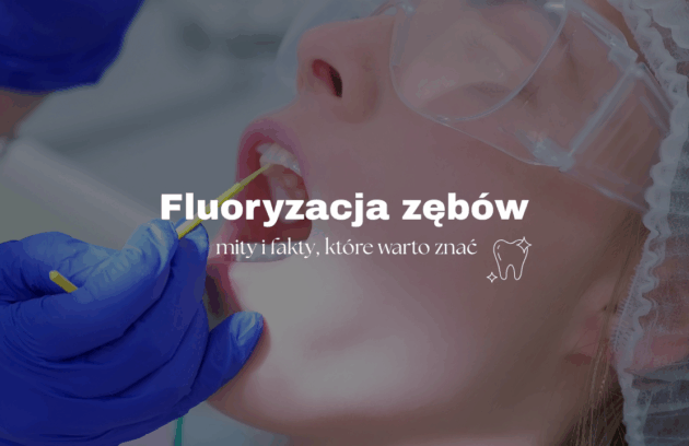 Fluoryzacja zębów – mity i fakty, które warto znać
