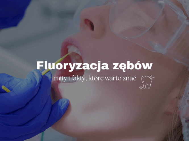 Fluoryzacja zębów – mity i fakty, które warto znać