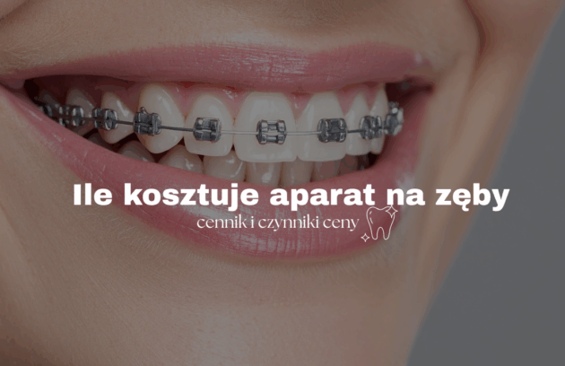 Ile kosztuje aparat na zęby – cennik i czynniki ceny