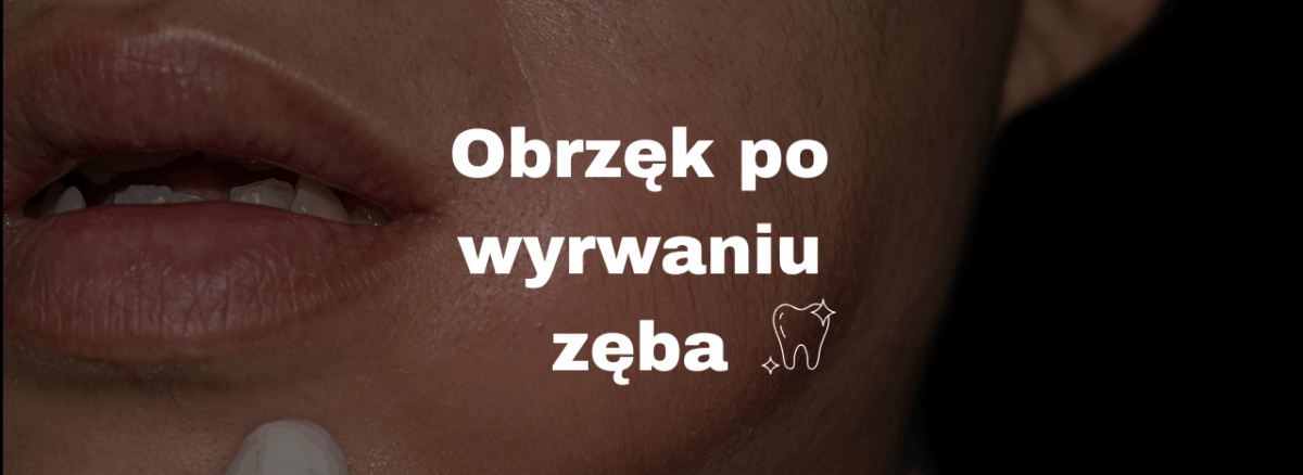 Obrzęk po wyrwaniu zęba