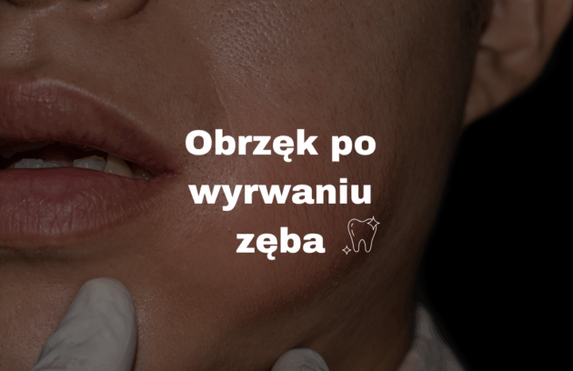 Obrzęk po wyrwaniu zęba