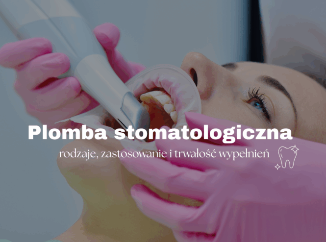 Plomba stomatologiczna – rodzaje, zastosowanie i trwałość wypełnień