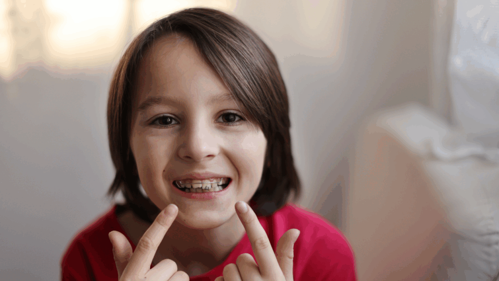 Proces zakładania aparatu – prawidłowy sposób umieszczania aparatu na zębach