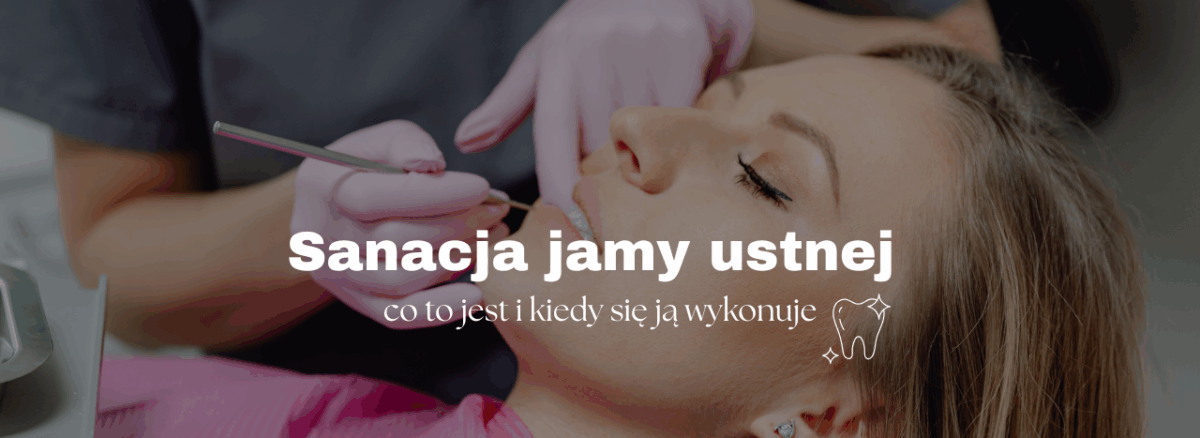 Sanacja jamy ustnej - co to jest i kiedy się ją wykonuje
