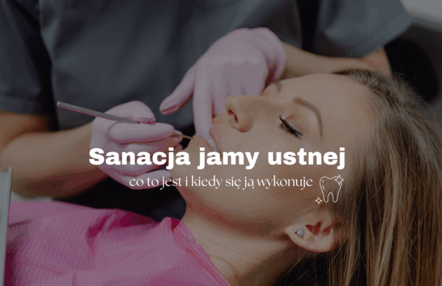 Sanacja jamy ustnej - co to jest i kiedy się ją wykonuje