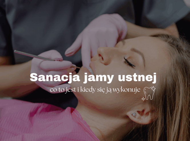 Sanacja jamy ustnej - co to jest i kiedy się ją wykonuje