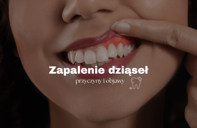 Zapalenie dziąseł – przyczyny i objawy