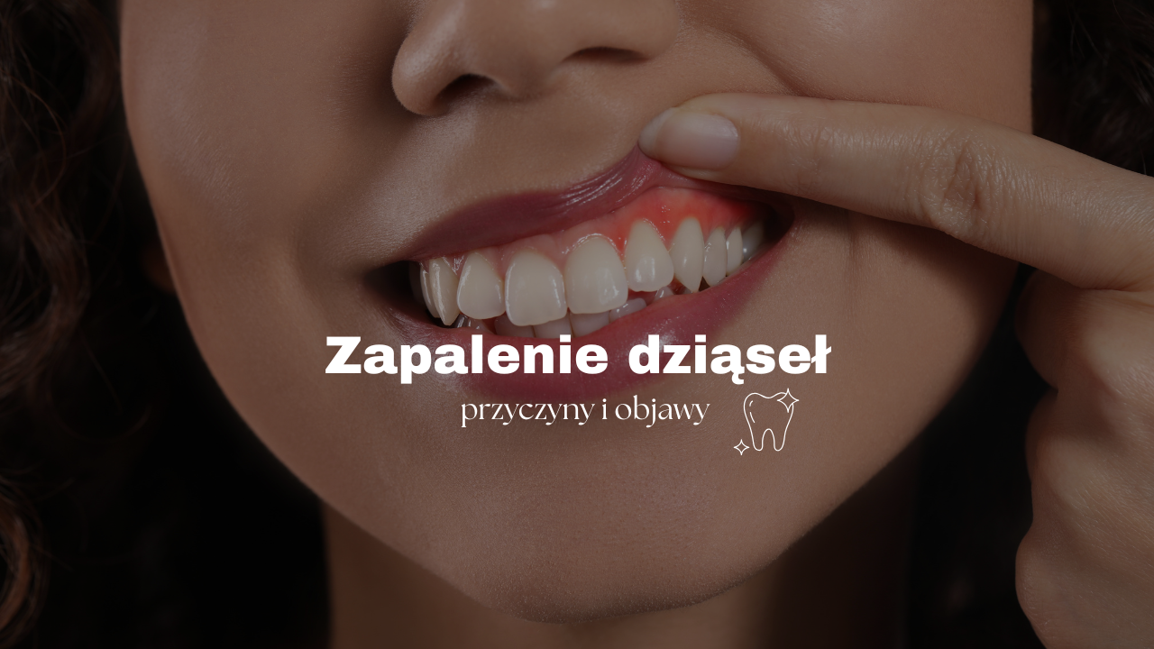 Zapalenie dziąseł – przyczyny i objawy