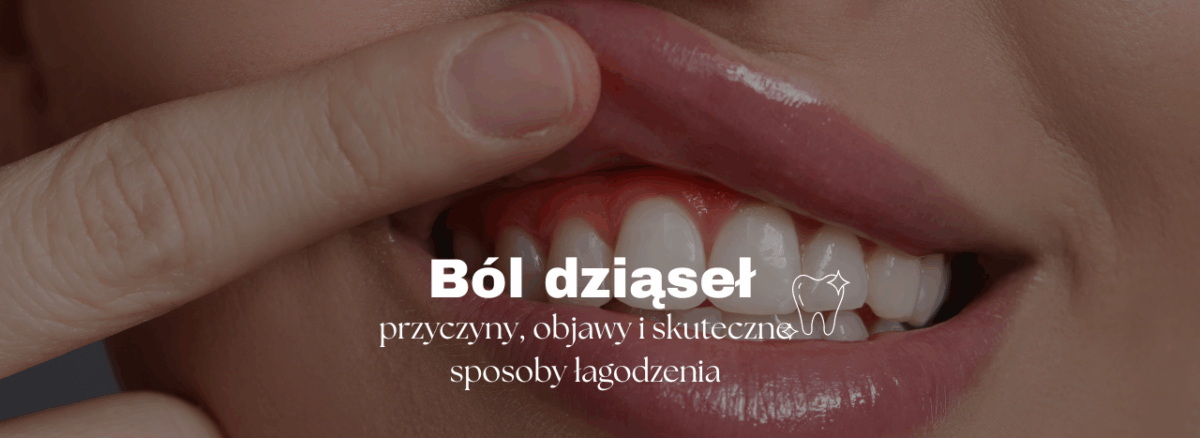 Ból dziąseł - przyczyny, objawy i skuteczne sposoby łagodzenia