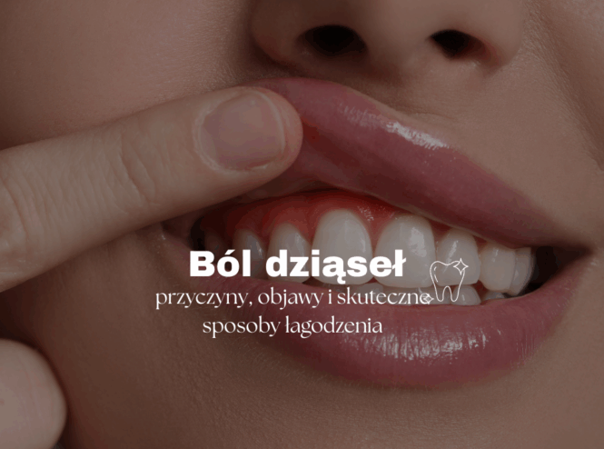 Ból dziąseł - przyczyny, objawy i skuteczne sposoby łagodzenia