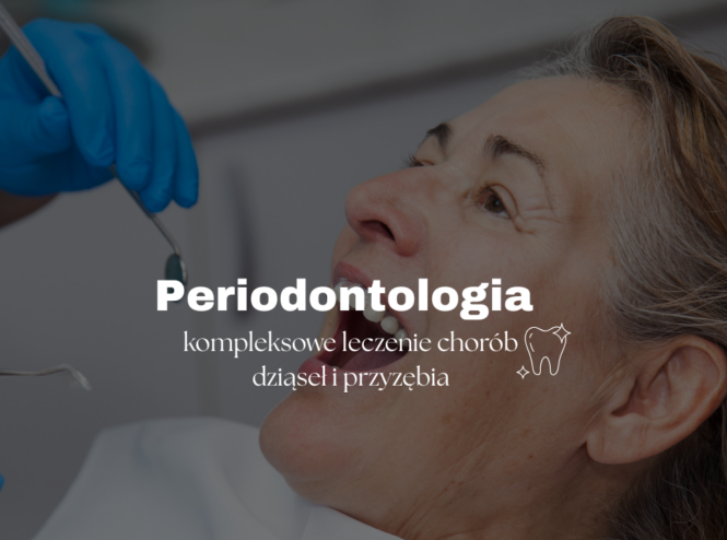 Periodontologia – kompleksowe leczenie chorób dziąseł i przyzębia