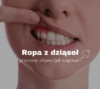 Ropa z dziąseł – przyczyny, objawy i jak reagować?
