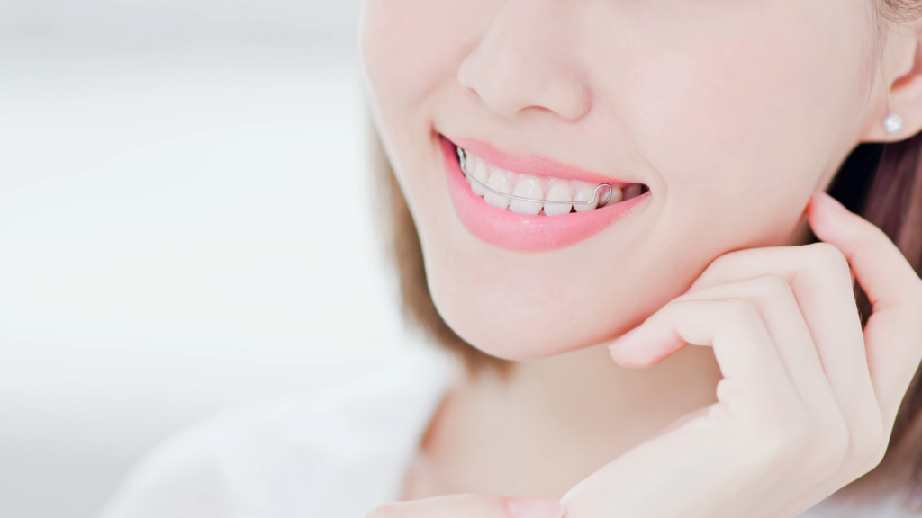 Świadome podejście do retencji pozwala uniknąć ponownego leczenia ortodontycznego