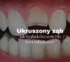 Ukruszony ząb - jak wygląda leczenie i ile trwa odbudowa?